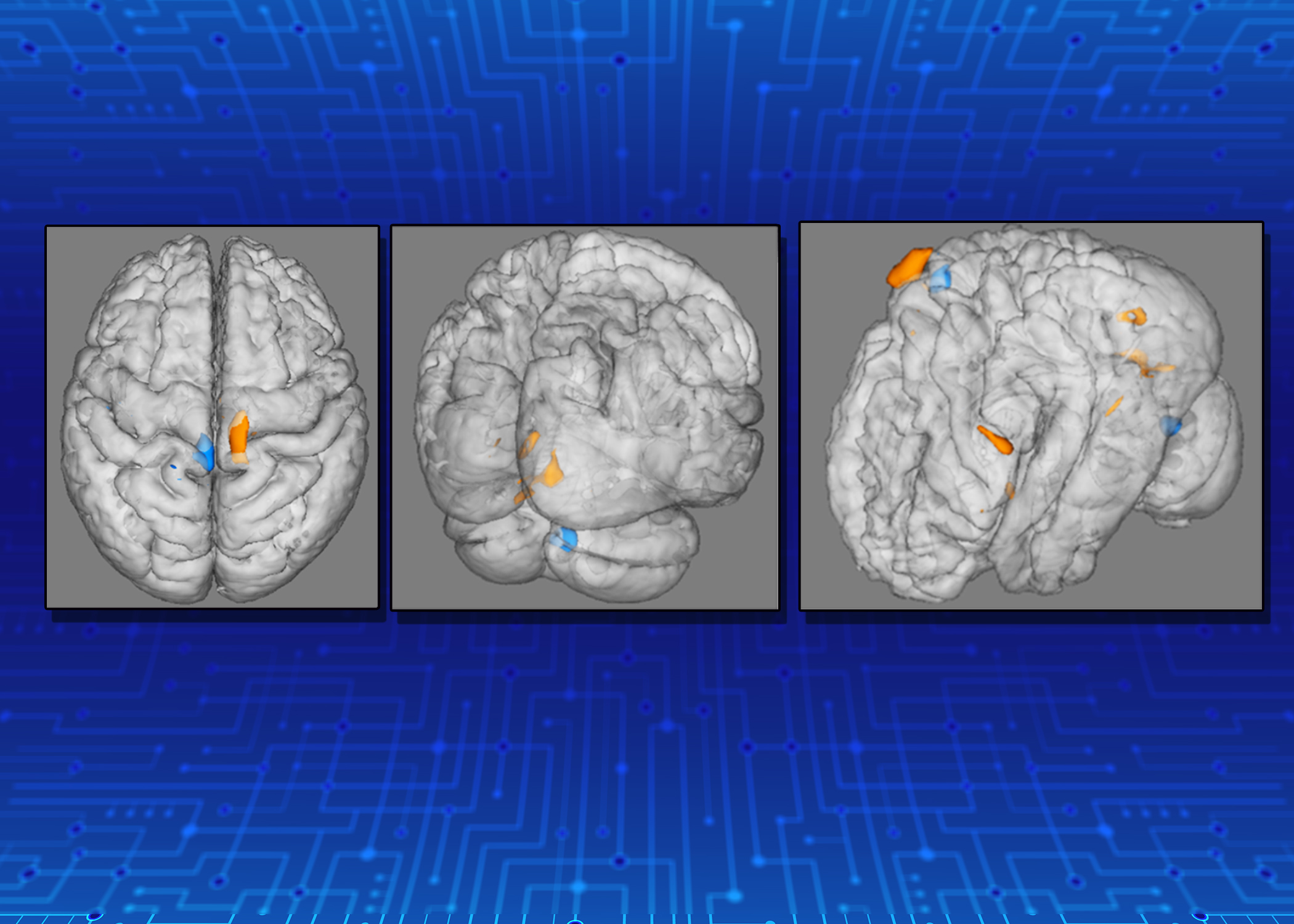Study When You Injure Your Knee, It Changes Your Brain Ohio State