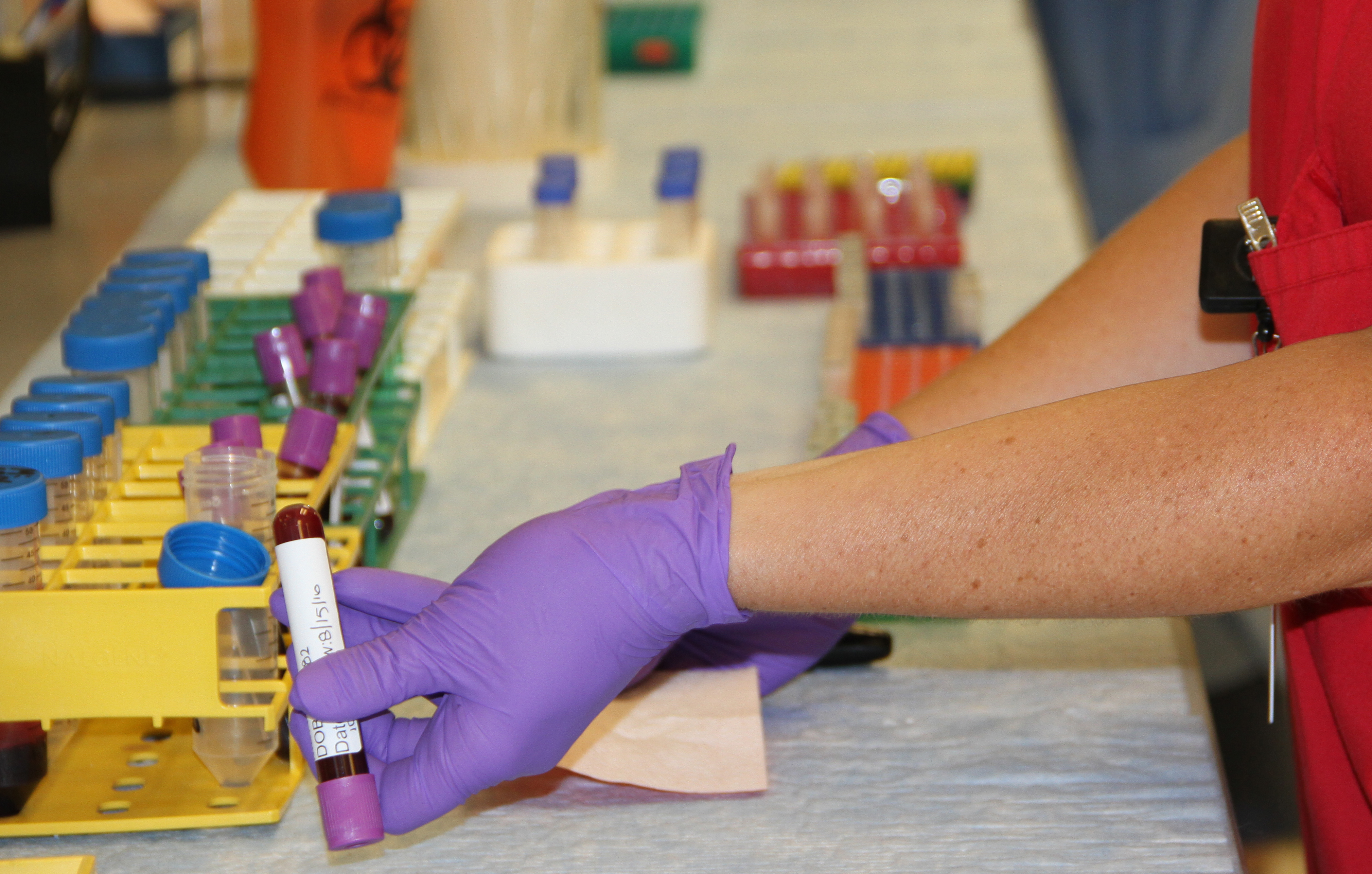 How A Simple Blood Test Could Add 639 Years Of Life To Ohioans James